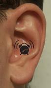 Tinnitus uert sich als permanentes Gerusch im Ohr